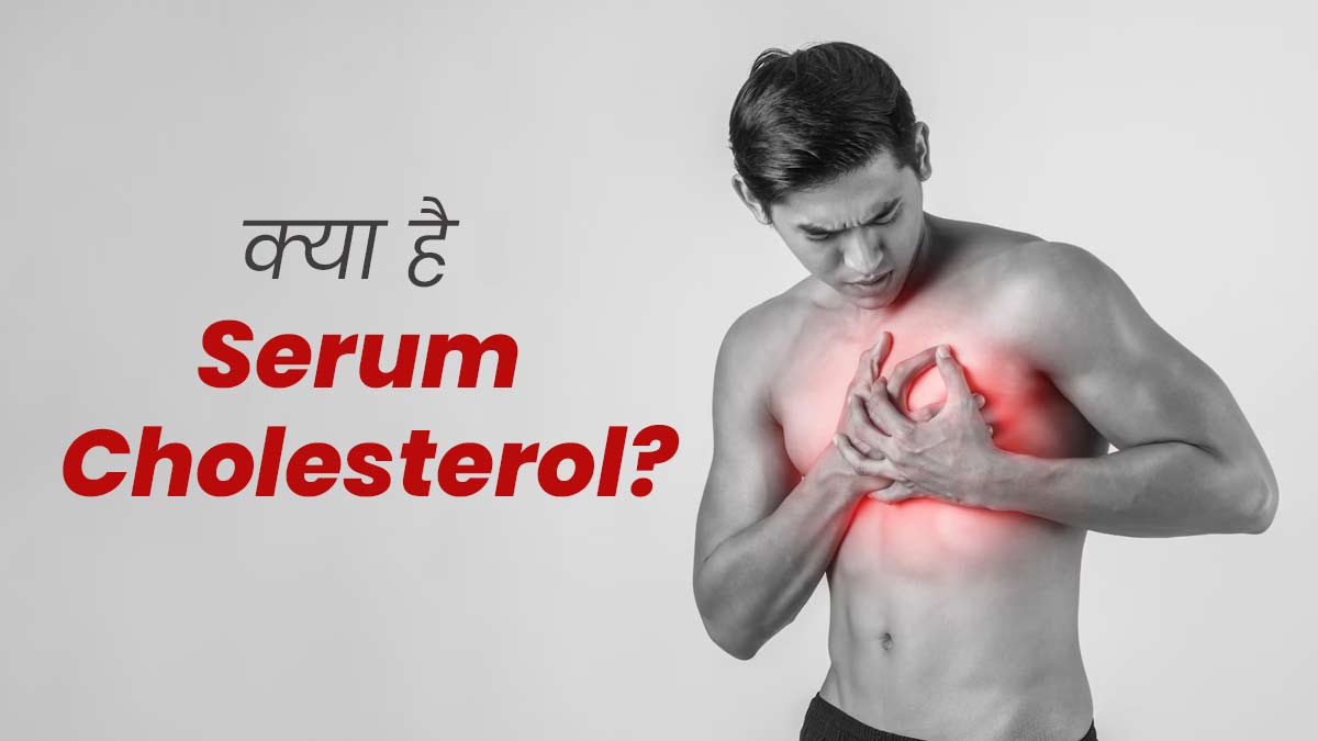 Serum Cholesterol: सीरम कोलेस्ट्रॉल क्या होता है? एक्सपर्ट से जानें क्यों है यह जरूरी