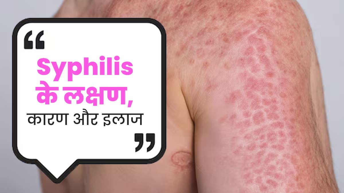 Syphilis: असुरक्षित यौन संबंध बनाने से हो सकती है ये गंभीर बीमारी, जानें इसके लक्षण, कारण और इलाज