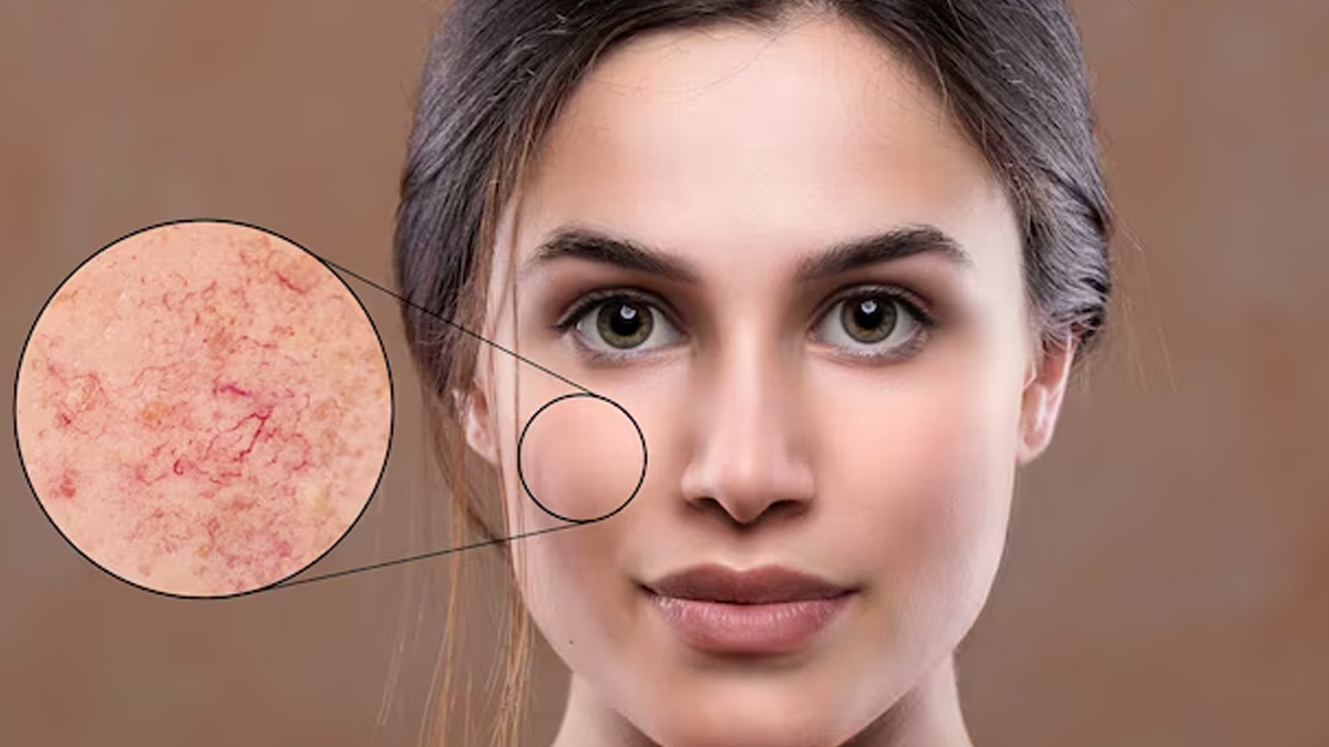 Vitamin Deficiency Causes Skin Darkening