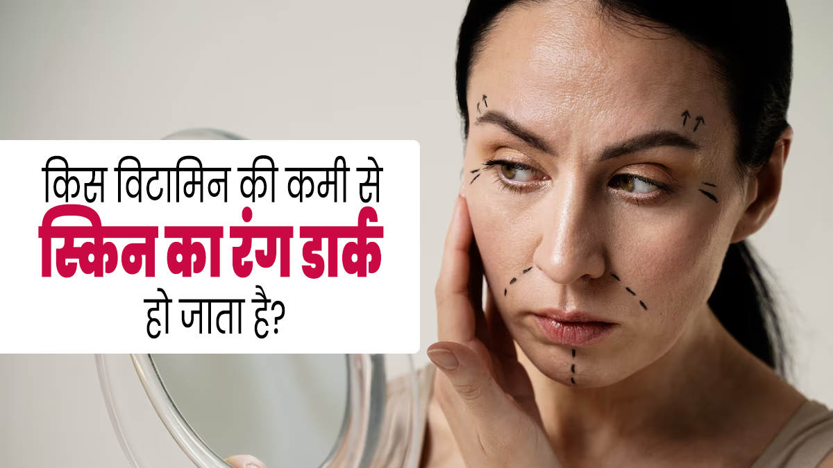 किस विटामिन की कमी से स्किन का रंग डार्क हो जाता है? डॉक्टर से समझें