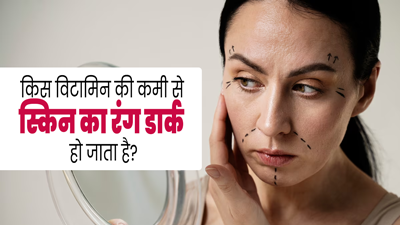 किस विटामिन की कमी से स्किन का रंग डार्क हो जाता है? डॉक्टर से समझें