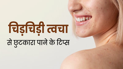 गर्मियों में ड्राई और बेजान स्किन से छुटकारा पाने के लिए अपनाएं ये 5 टिप्स, दूर होगी समस्या