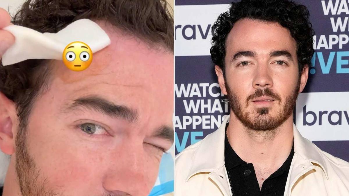 Kevin Jonas Asks Fans To Prioritize Health As He Undergoes Surgery To Remove Skin Cancer; Types Of Skin Cancer