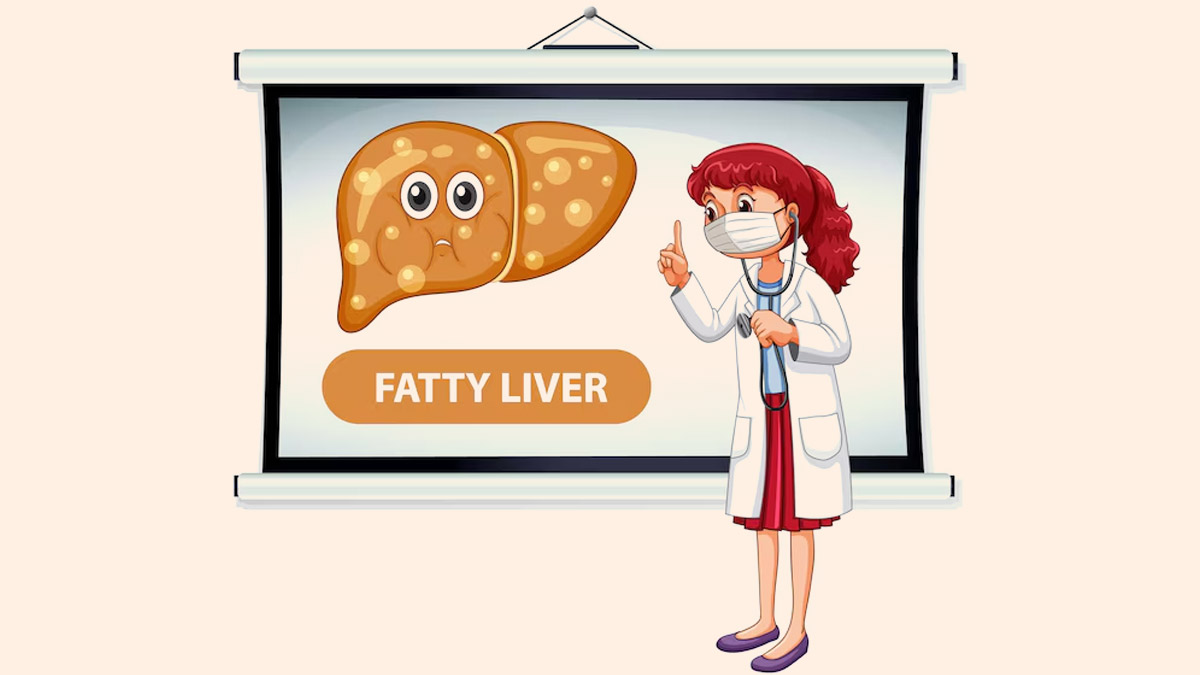 Global Fatty Liver Day 2024: Explore Theme, History And Its Significance