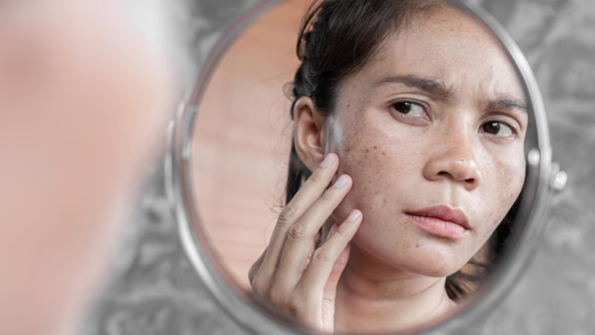 Excessive Salt Intake Side Effects on Skin in Hindi