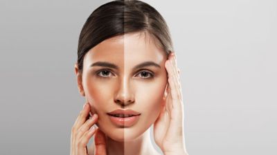 कुछ लोगों को टैनिंग ज्यादा क्यों होती है? एक्सपर्ट से जानें इसके कारण