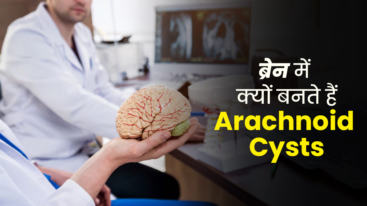 Arachnoid Cysts: आर्कनॉइड सिस्ट क्या होता है? डॉक्टर से जानें ब्रेन में कैसे होती है इसकी शुरुआत 