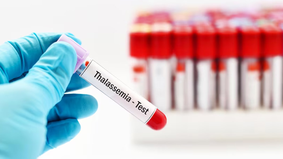 Can Prenatal Testing Help In Preventing Thalassemia?