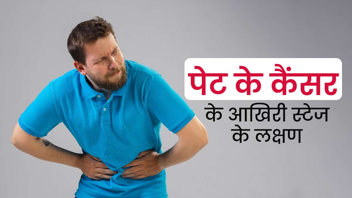 पेट में कैंसर के लास्ट स्टेज में नजर आ सकते हैं ये लक्षण, न करें नजरअंदाज