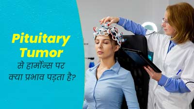 पिट्यूटरी ट्यूमर बन सकता है हार्मोन्स के असंतुलन का कारण, डॉक्टर से जानें बचाव के तरीके