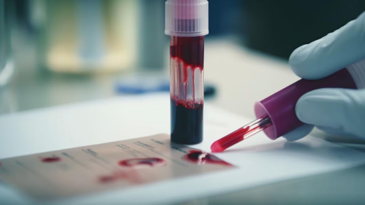 The Blood Type So Rare It's Called Golden: An Explainer Of One In A Million ‘Golden Blood Type’