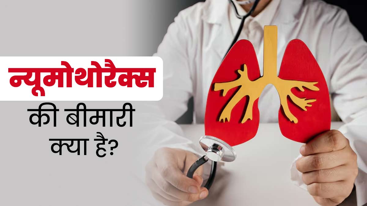 फेफड़ों से जुड़ी गंभीर बीमारी है न्यूमोथोरैक्स, जानें इसके लक्षण, कारण और बचाव