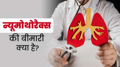 फेफड़ों से जुड़ी गंभीर बीमारी है न्यूमोथोरैक्स, जानें इसके लक्षण, कारण और बचाव
