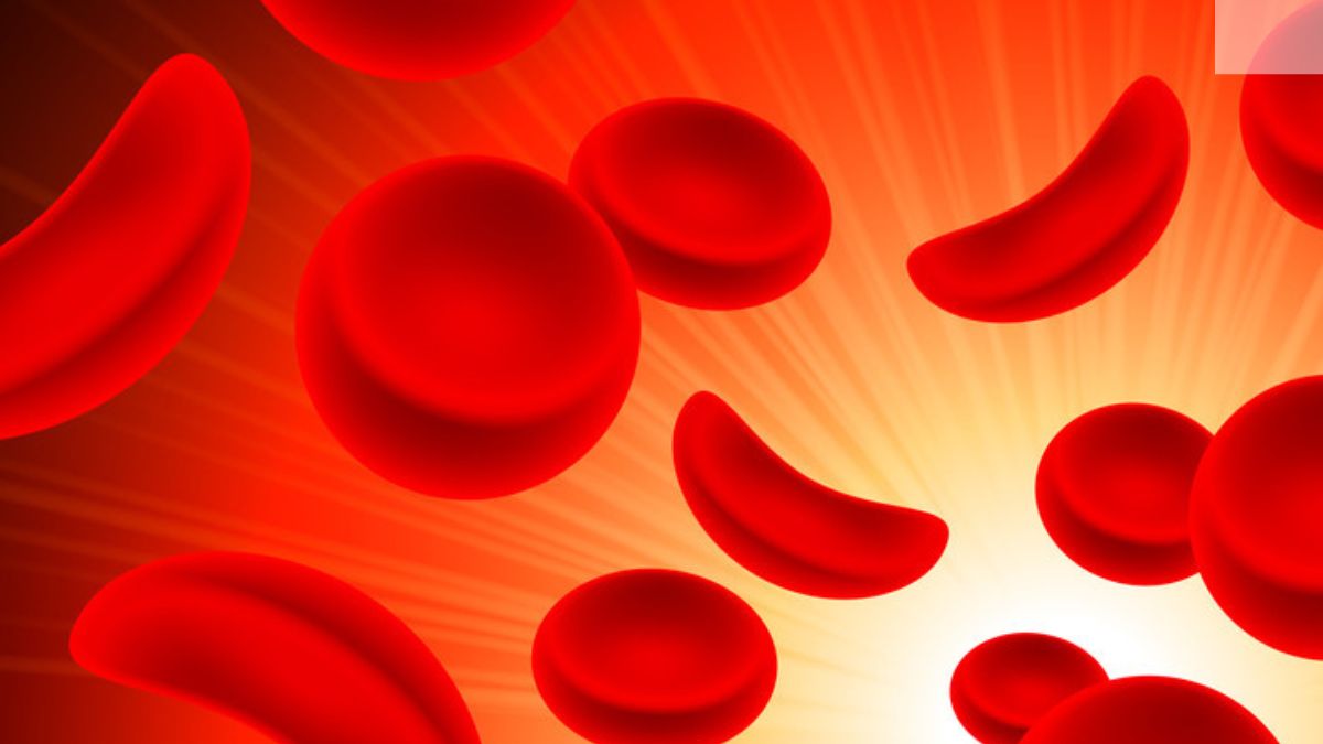 World Sickle Cell Anemia Day 2024: Theme, Importance, Why It's Observed