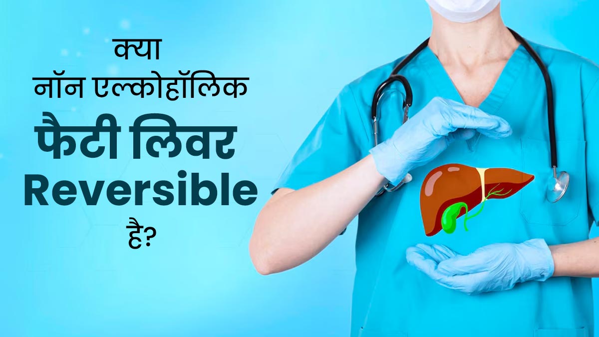 क्या नॉन एल्कोहॉलिक फैटी लिवर डिजीज को रिवर्स किया जा सकता है? एक्सपर्ट से जानें
