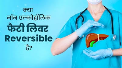 क्या नॉन एल्कोहॉलिक फैटी लिवर डिजीज को रिवर्स किया जा सकता है? एक्सपर्ट से जानें