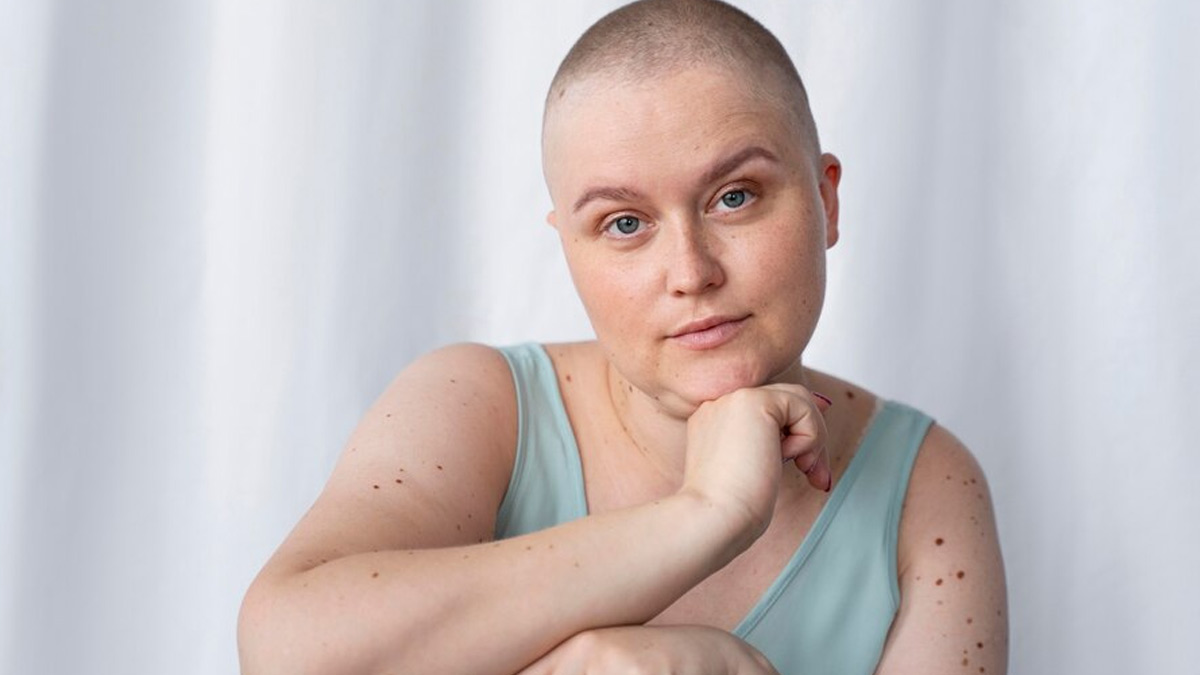 Fair-Skinned People More At Risk Of Skin Cancer? Here's What A Doctor Has To Say