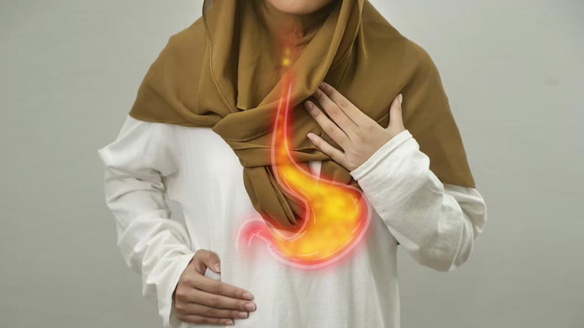 Managing GERD: The Best Time To Eat Your Dinner If You Have Acid Reflux