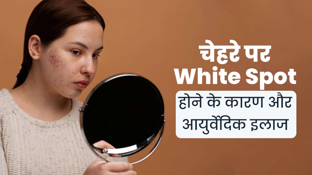क्या आपके चेहरे पर भी हो रहे हैं व्हाइट स्पॉट? जानें इसके कारण और आयुर्वेदिक उपाय 