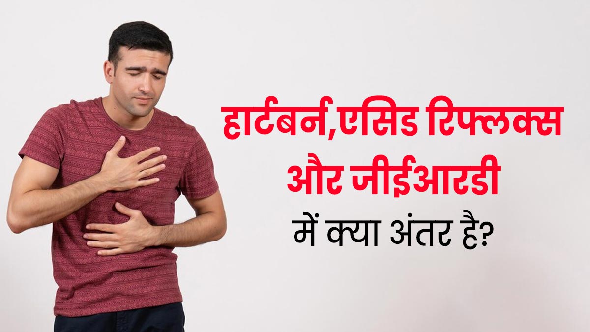 हार्टबर्न, एसिड रिफलक्स और जीईआरडी में क्या अंतर है? जानें बचाव