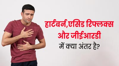 हार्टबर्न, एसिड रिफलक्स और जीईआरडी में क्या अंतर है? जानें बचाव
