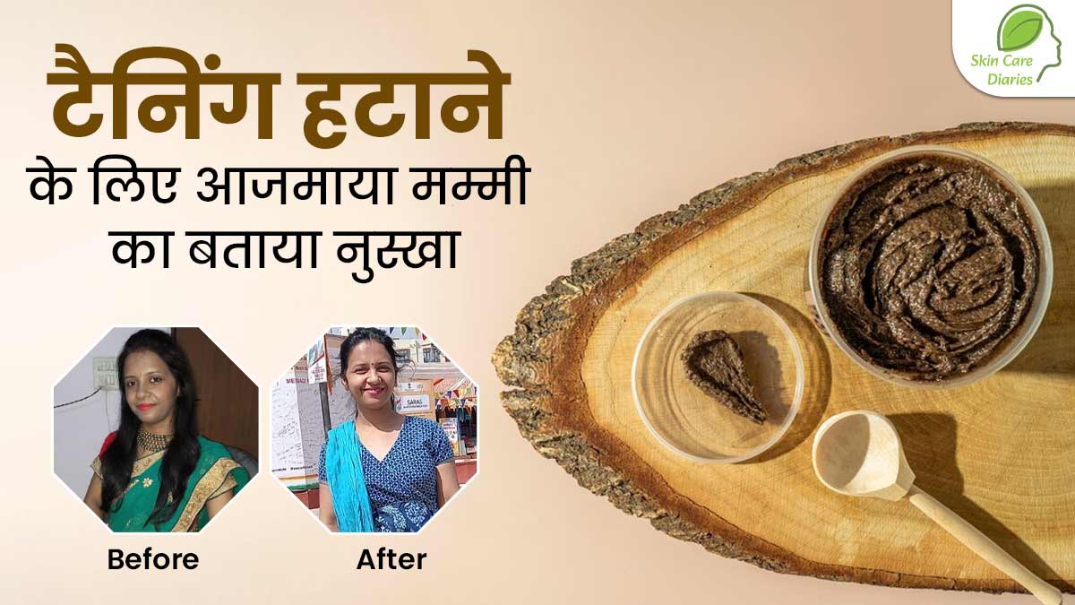 Skincare Diaries: त्वचा से टैनिंग हटाने के लिए अभिलाषा ने आजमाया मम्मी का बताया खास नुस्खा, आप भी करें ट्राई
