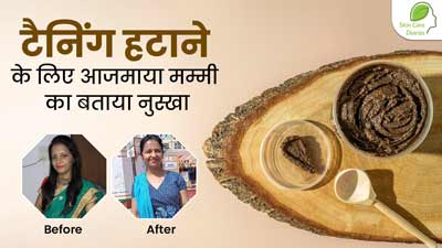 Skincare Diaries: त्वचा से टैनिंग हटाने के लिए अभिलाषा ने आजमाया मम्मी का बताया खास नुस्खा, आप भी करें ट्राई