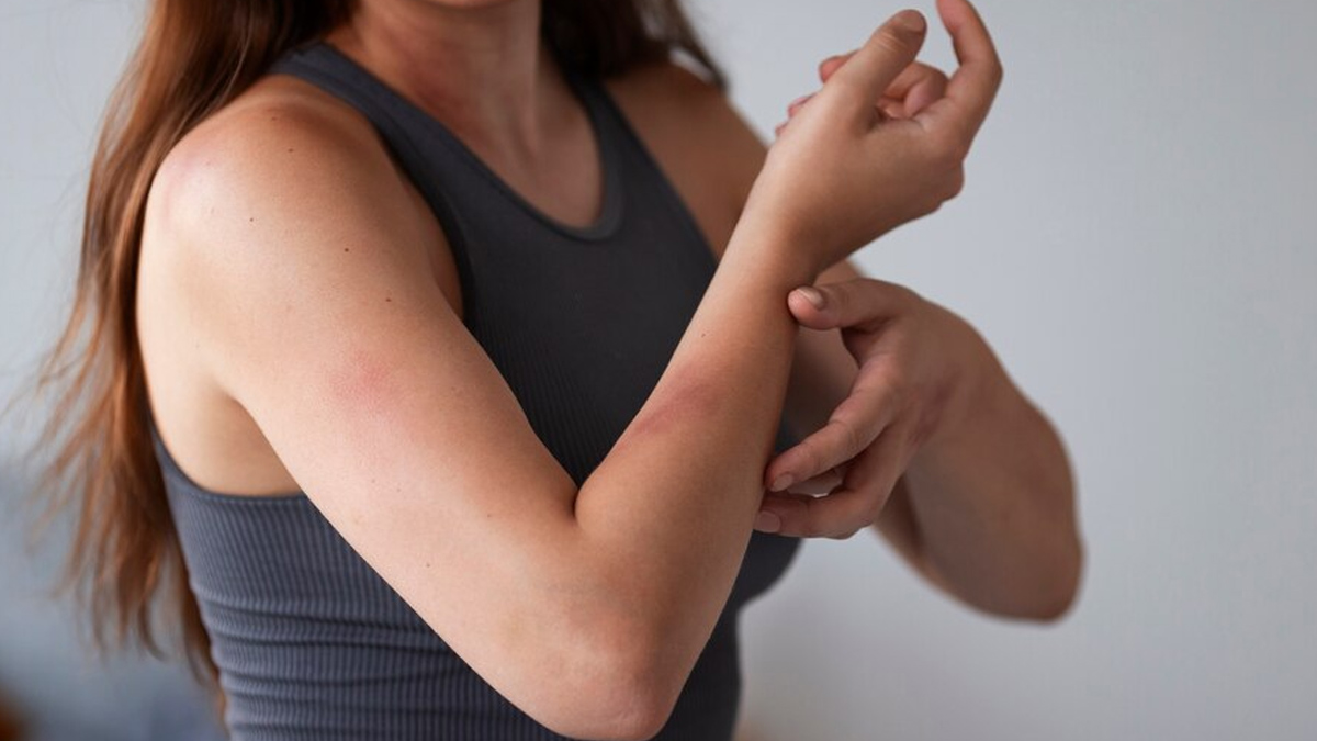 tea tree oil for bacterial skin infection
