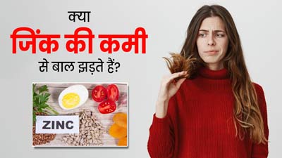 क्या शरीर में जिंक की कमी होने से बाल झड़ते हैं? एक्सपर्ट से जानें बचाव