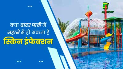 क्या वाटर पार्क में नहाने से हो सकता है स्किन इंफेक्शन, जानें क्या कहते हैं डॉक्टर