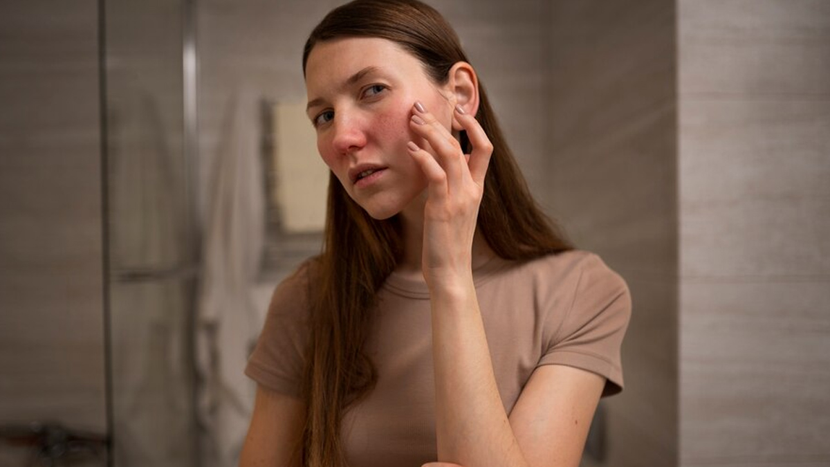 skin-inflammation