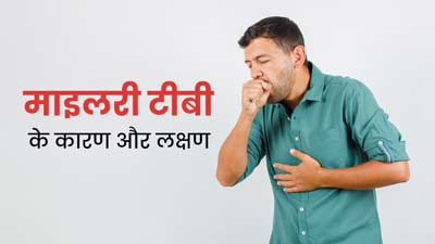 आपके अंगों के लिए घातक हो सकती है माइलरी टीबी, जानें इसके कारण और लक्षण 