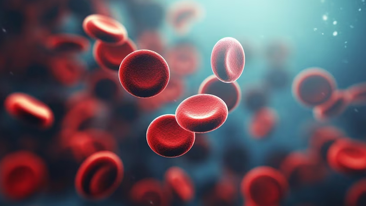 Anaemia In Men: Causes And Symptoms