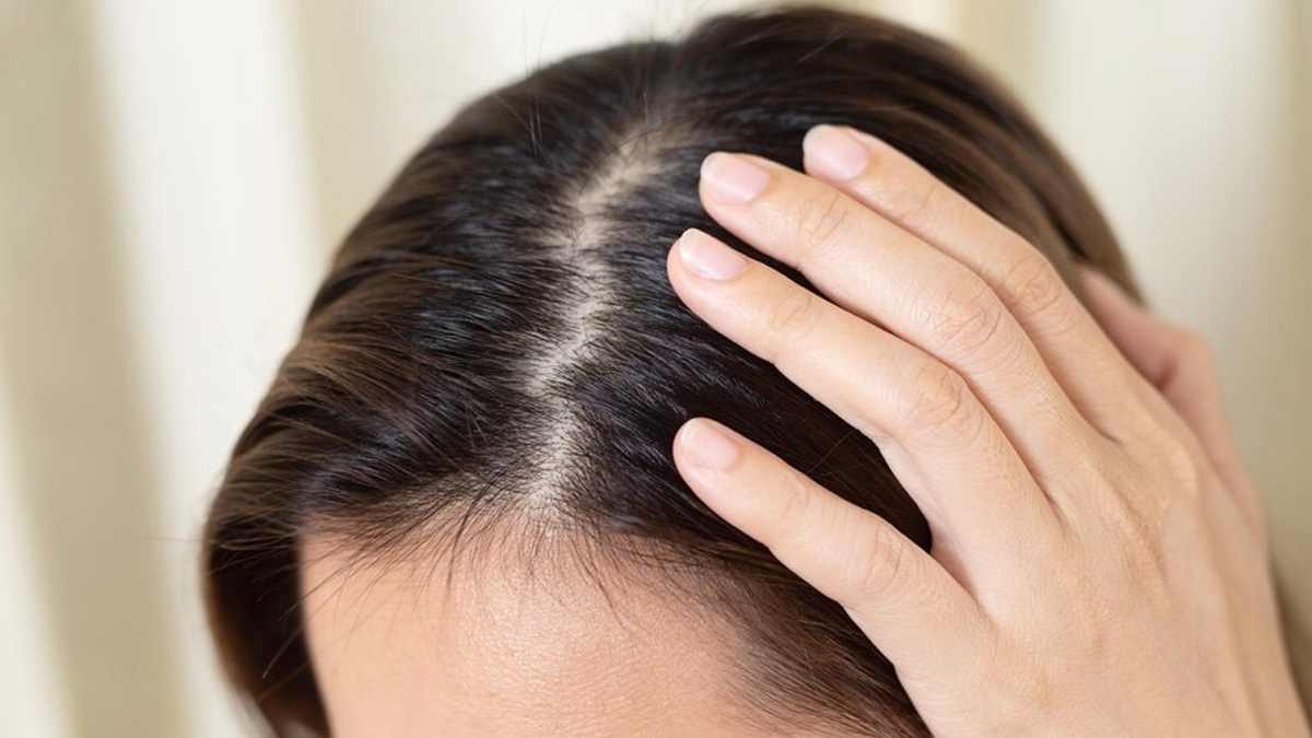 scalp popping in hindi