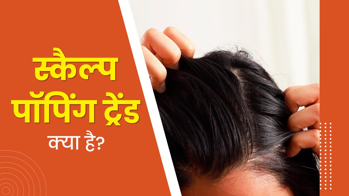 क्‍या है इंटरनेट पर पॉपुलर हो रहा 'स्‍कैल्‍प पॉप‍िंग' ट्रेंड? जानें बालों के ल‍िए क्‍यों है यह हान‍िकारक 
