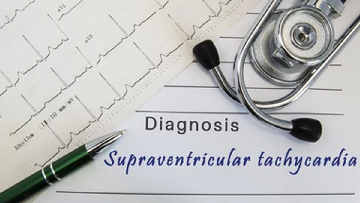 Supraventricular-Tachycardia
