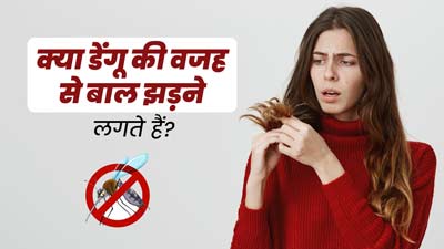 क्या डेंगू की वजह से बाल झड़ने लगते हैं? जानें इसके कारण और बचाव