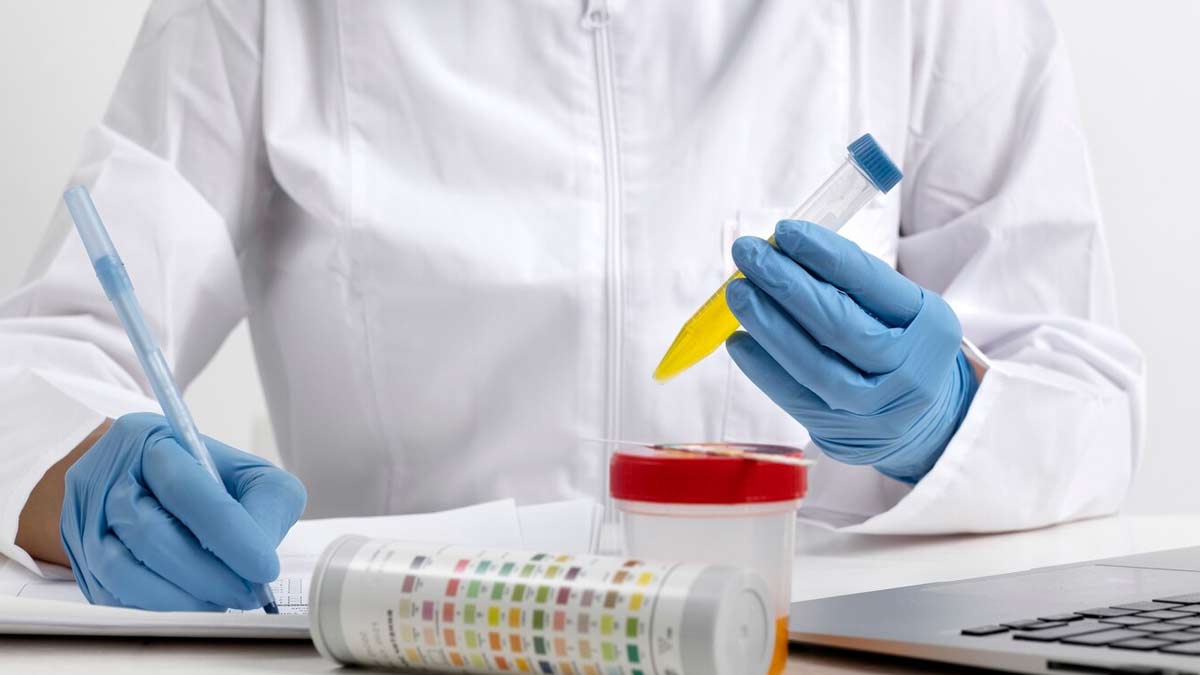 Normal Range of PUS Cells in Urine
