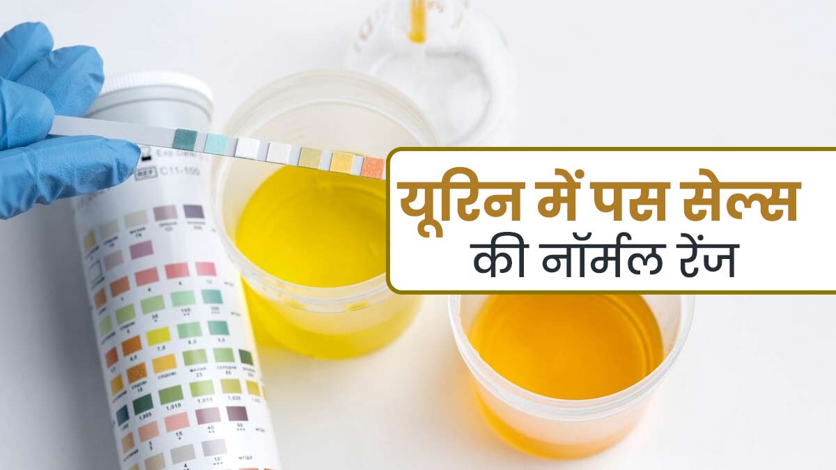 उम्र के हिसाब से यूरिन में पस सेल्‍स की नॉर्मल रेंज कितनी होनी चाहिए? जानें डॉक्टर से