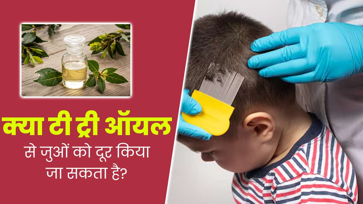 क्या टी ट्री ऑयल जुओं की समस्या दूर कर सकता है? इस तरह से करें उपयोग