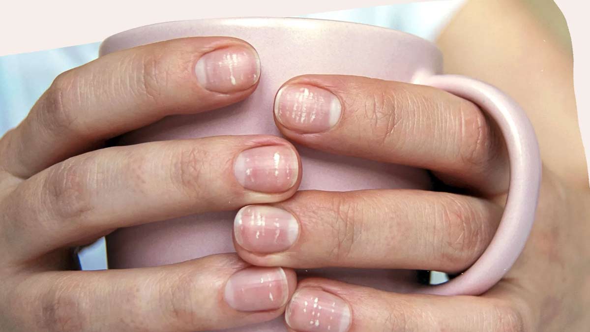 terry nails in hindi