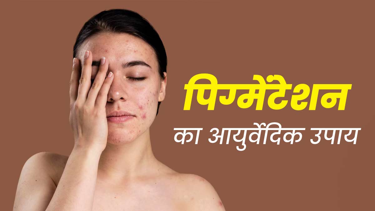 मुंह के आस-पास की स्किन पर हो गई है पिग्मेंटेशन, तो दूर करने के लिए अपनाएं ये आयुर्वेदिक उपाय