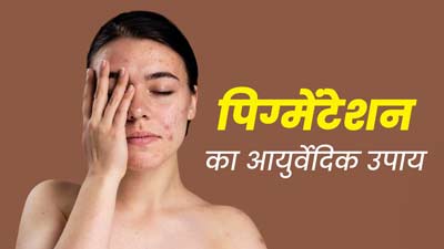 मुंह के आस-पास की स्किन पर हो गई है पिग्मेंटेशन, तो दूर करने के लिए अपनाएं ये आयुर्वेदिक उपाय