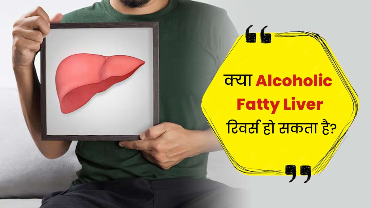 क्या एल्कोहॉलिक फैटी लिवर रिवर्स हो सकता है? जानें एक्सपर्ट से