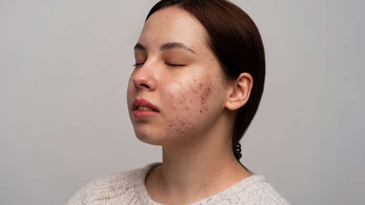 causes of blemishes in hindi