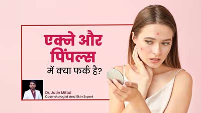 एक्ने और पिंपल्स में अंतर कैसे पहचानें? जानें दोनों समस्याओं के लक्षण और बचाव के उपाय