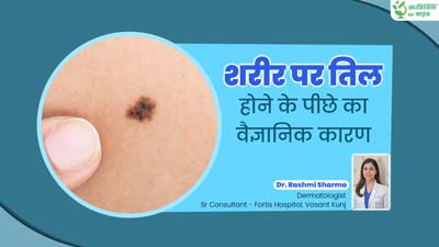 अंधविश्वास या साइंस: क्या वाकई हथेली पर तिल होना अमीरी का संकेत होता है? डॉक्टर से जानें वैज्ञानिक तथ्य
