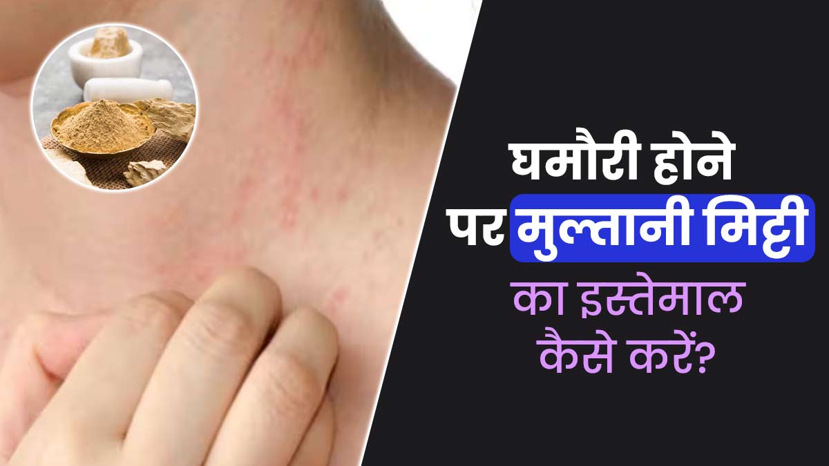 घमौरी के लिए मुल्तानी मिट्टी का इस्तेमाल कैसे करें? जानें इसके फायदे 