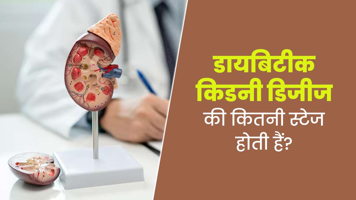 डायबिटीक किडनी डिजीज के होते हैं 5 स्टेज, लक्षणों से जानें कौन-सी स्टेज में हैं आप
