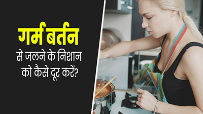 किचन में काम करते समय जल गई है त्वचा, तो राहत पाने के लिए अपनाएं ये 5 घरेलू उपाय